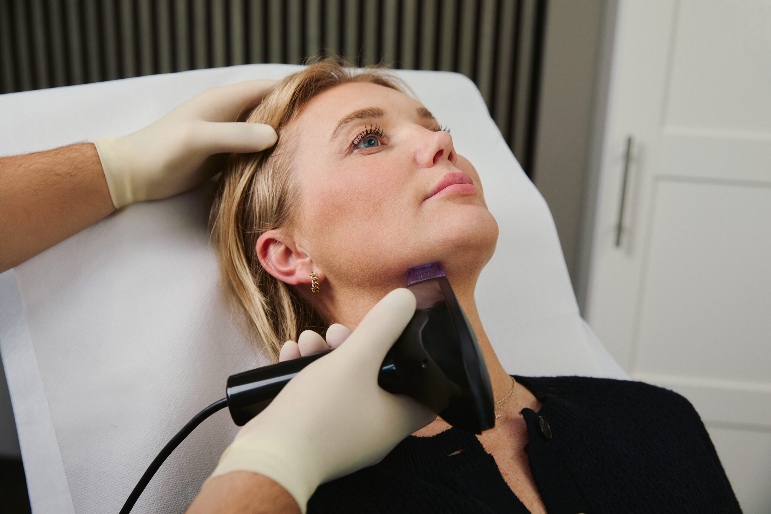 Morpheus 8 Behandlung bei einer Patientin