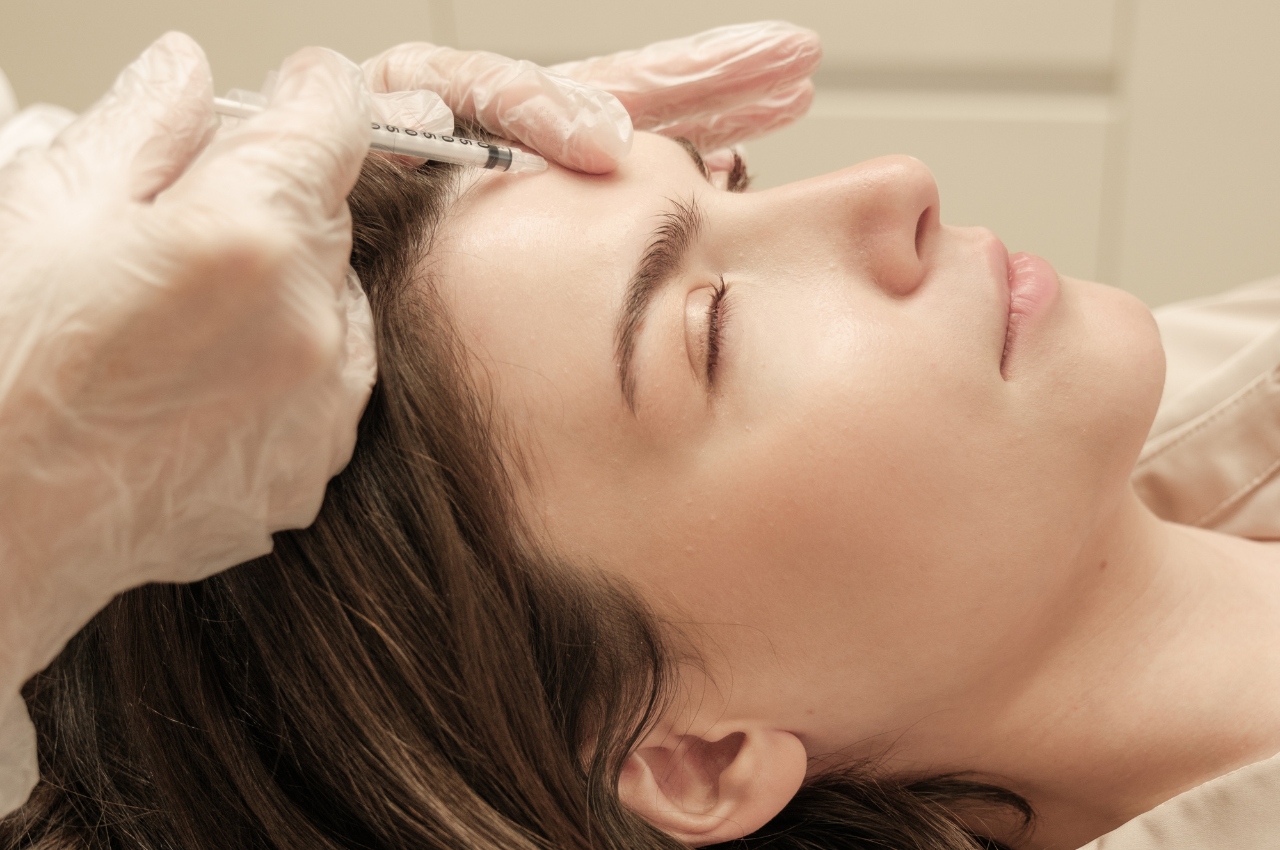 Hyaluron Unterspritzung in der Stirn