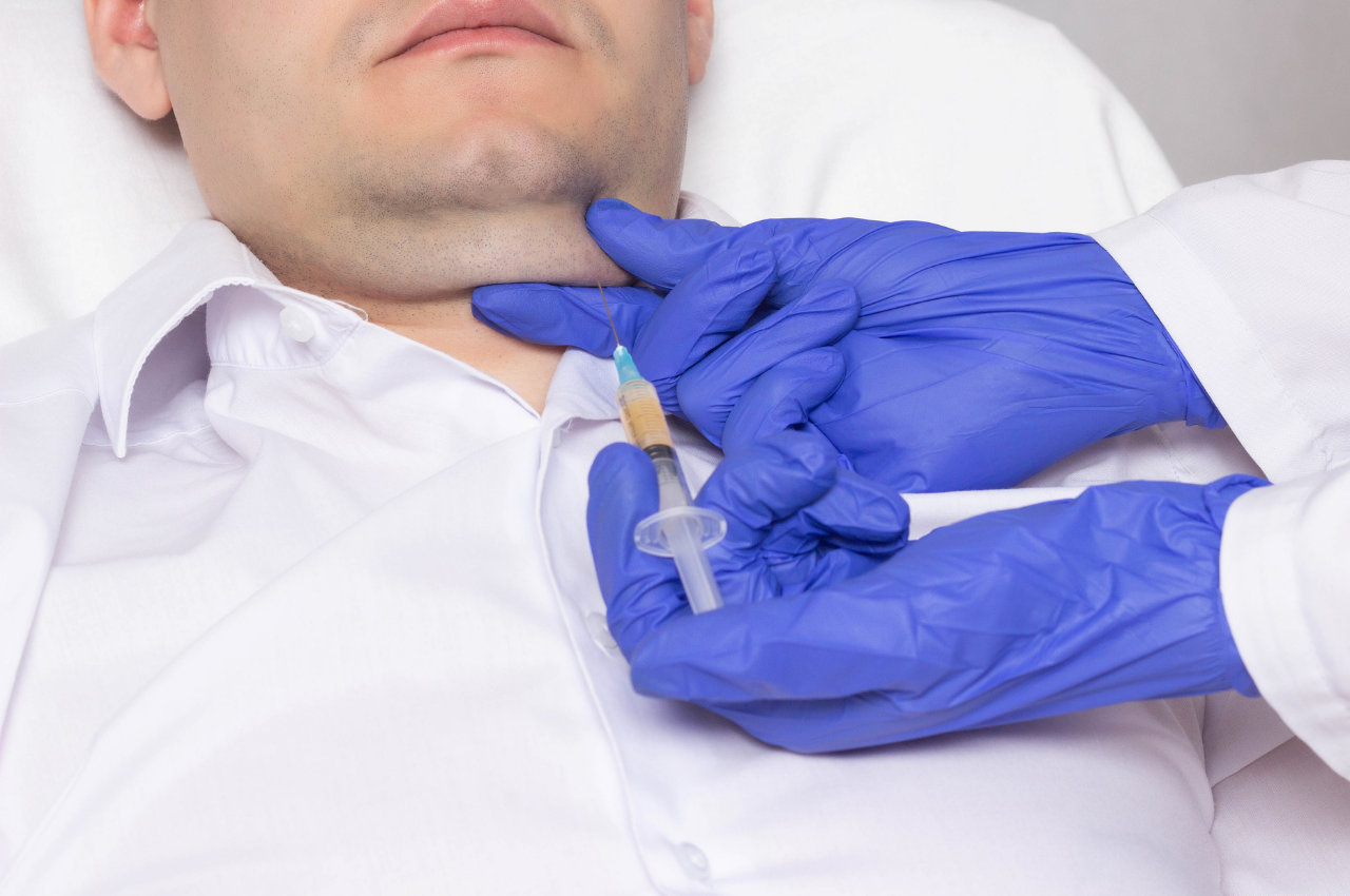 Eigenfettunterspritzung im Gesicht beim Mann