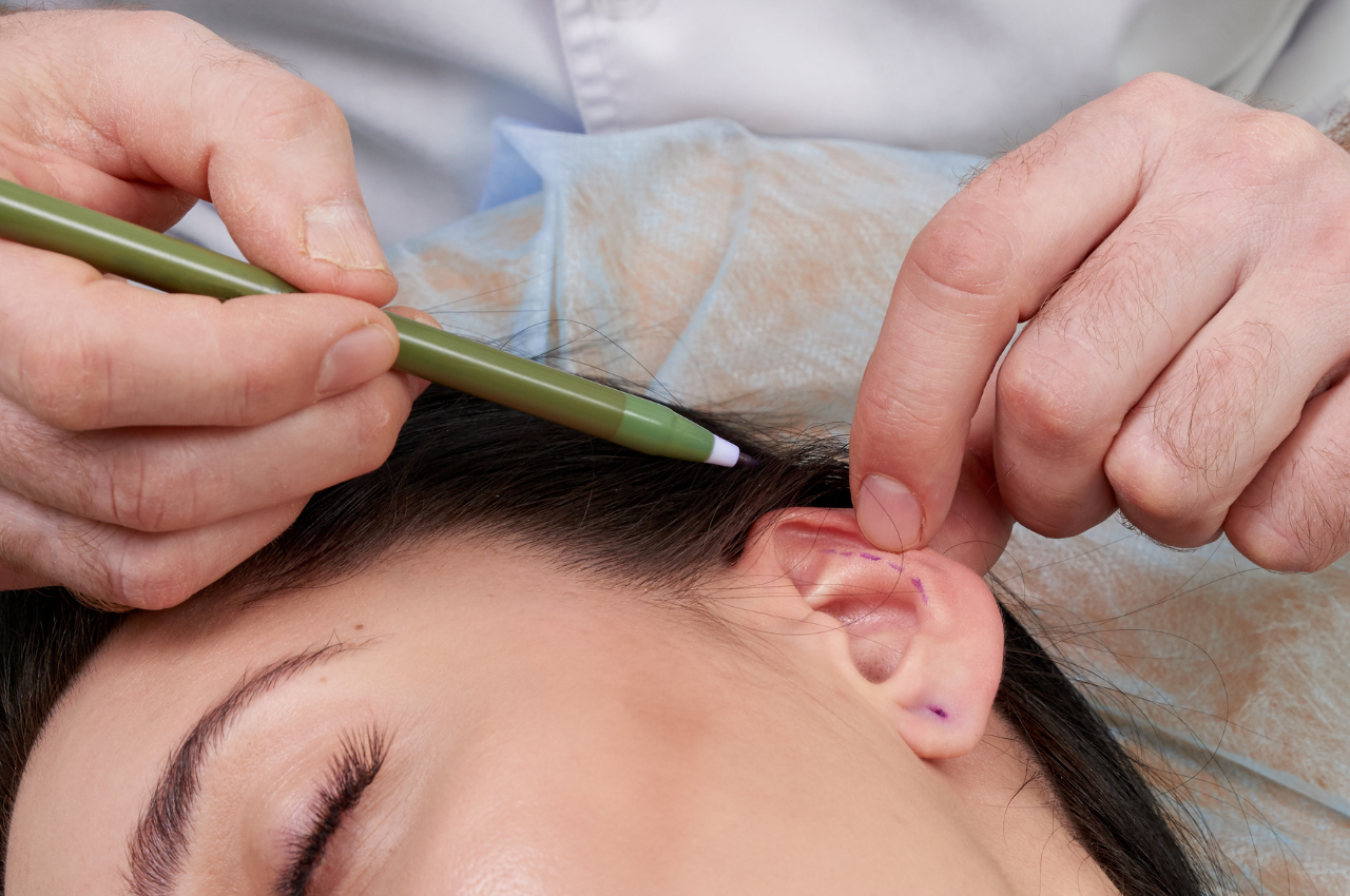 Behandlungsgespräch zur Ohrenkorrektur, auch Otopexie genannt